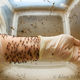 Illustration for article titled Mosquito Researcher Offers Her Own Arm To Hungry Mosquitoes